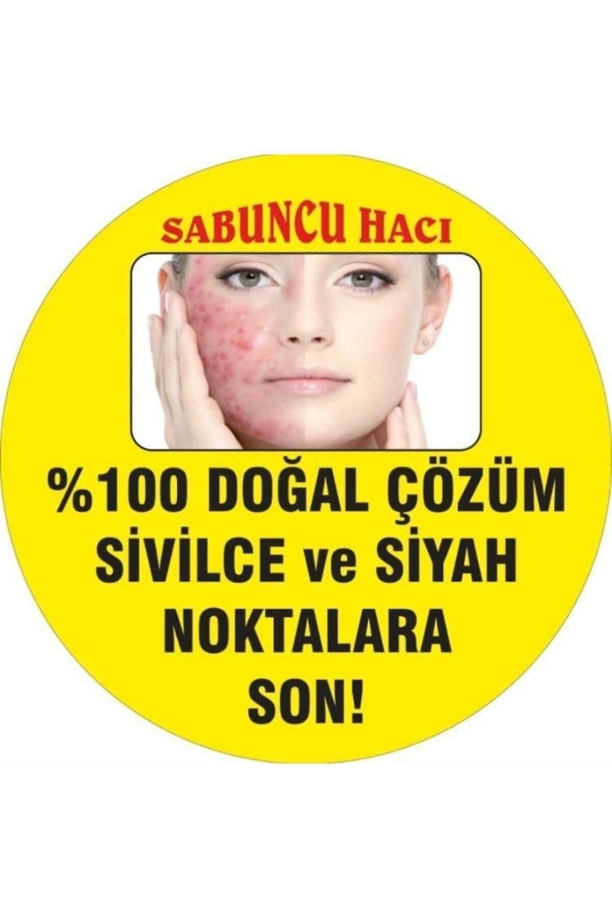 Sivilce Ve Akne Karıştı Siyah Nokta Gidermeye Gözenek Sıkılaştırmaya ( Çöven Otu) Katkılı 100gr