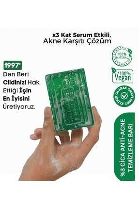 Anti-Akne-Seife – 3x Akne-Serum, wirksame Akne-Reinigungsseife – Anti-Akne-Seife, 120 gr